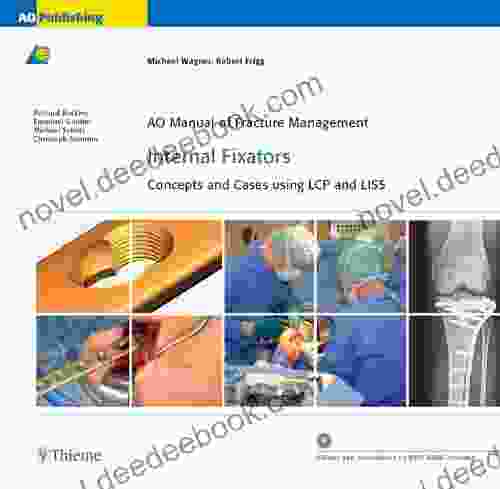 AO Manual Of Fracture Management: Internal Fixators: Concepts And Cases Using LCP/LISS (AO Manual Of Fracture Management Series)